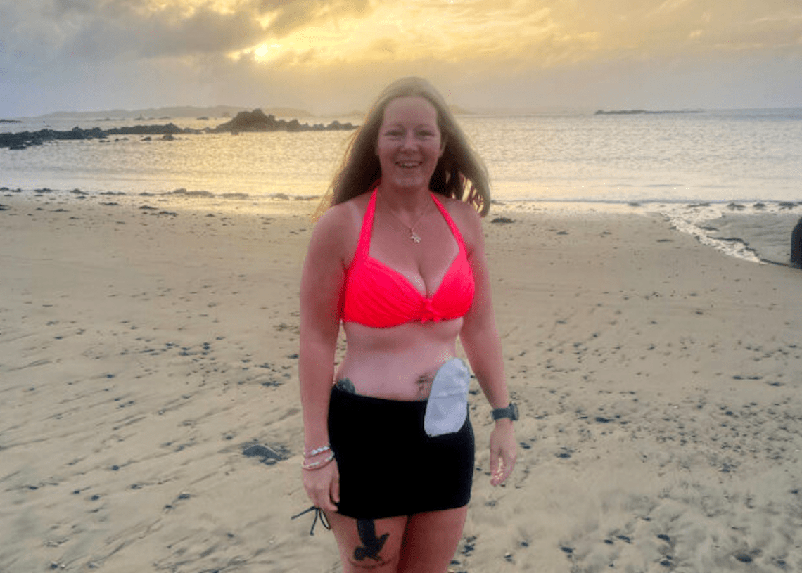Swimming with a colostomy